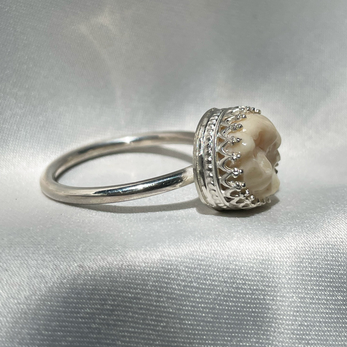 Wisdom Tooth Crown Ring  - Custom made